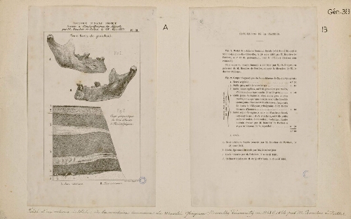 A) Mâchoire humaine fossile trouvée à Moulin Quignon-lès-Abbeville par M. Boucher de Perthes, le 28 mars 1863. Pl. III. - Tiré d'un volume intitulé de la mâchoire humaine du Moulin Quignon : nouvelles découvertes en 1863 & 1864, par M. Boucher de Perthes.