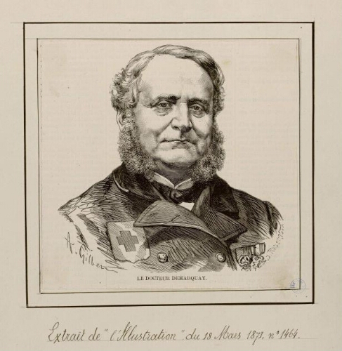 Le Docteur Demarquay, né à Longueval, canton d'Albert, arr. de Péronne. - A. Gilbert, del. - J. Robert, sculp. - Extr. de "L'Illustration" du 18 mars 1871, N°1464.